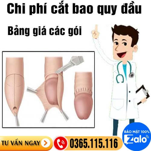 Chi phí cắt bao quy đầu hết bao nhiêu tiền? Bảng giá các gói 2025