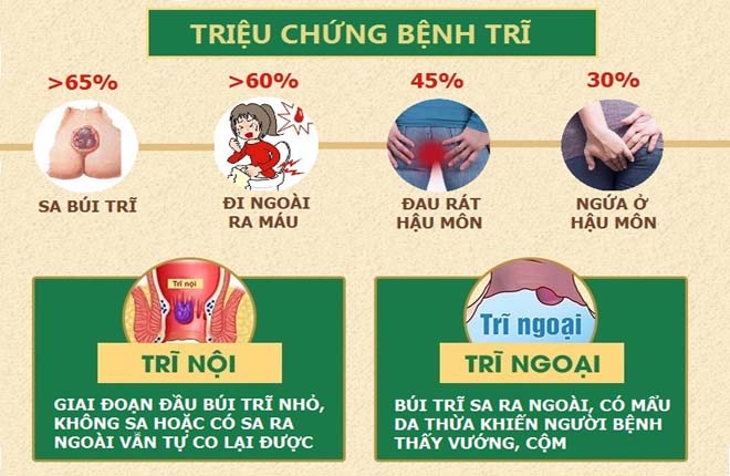 Chi phí chữa bệnh trĩ ở Hà Nội và chi phí cắt trĩ hết bao nhiêu tiền?