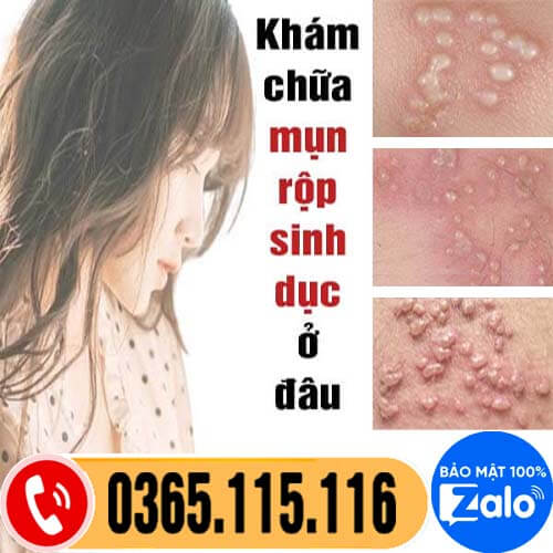 Top 10 địa chỉ khám chữa mụn rộp sinh dục ở đâu tốt nhất Hà Nội