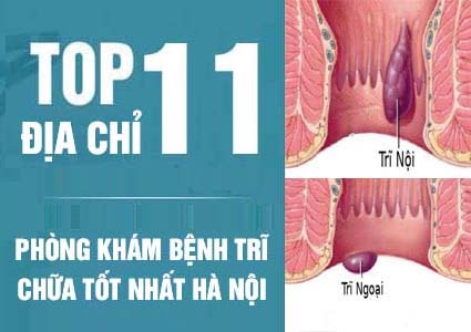 Top 11 phòng khám chữa bệnh trĩ ở đâu Hà Nội tốt nhất uy tín