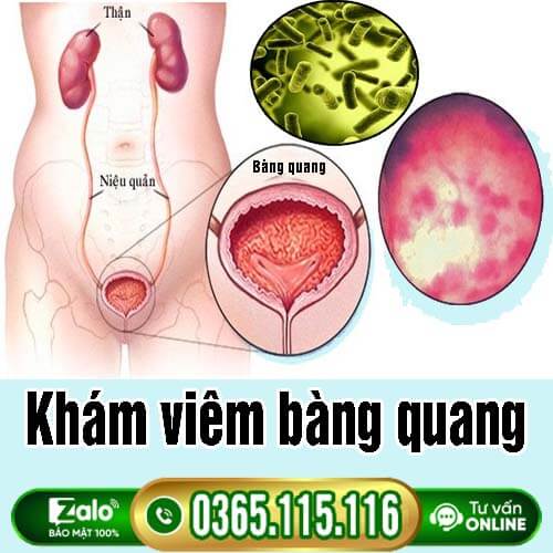 15 địa chỉ khám chữa viêm bàng quang ở đâu Hà Nội tốt uy tín 15 địa chỉ khám chữa viêm bàng quang ở đâu Hà Nội tốt uy tín