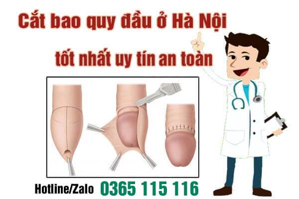 8 địa chỉ cắt bao quy đầu ở đâu tốt nhất an toàn tại Hà Nội