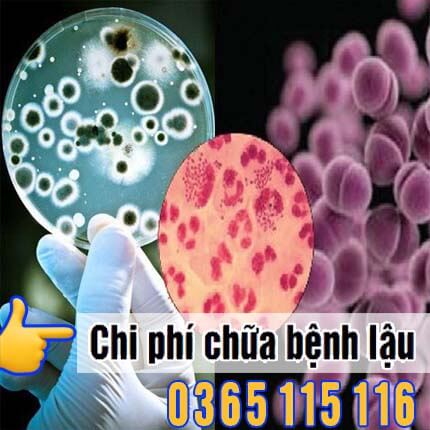 Chi phí chữa bệnh lậu hết bao nhiêu: Bảng giá tiền 2026 Hà Nội
