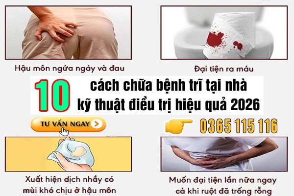 10 cách chữa bệnh trĩ tại nhà và kỹ thuật điều trị hiệu quả 2026