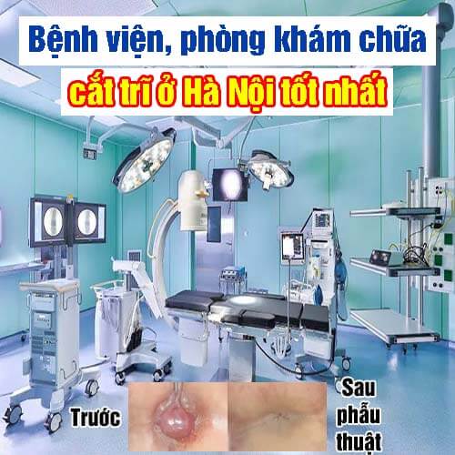 Top 9 bệnh viện, phòng khám chữa cắt trĩ ở Hà Nội tốt nhất Top 9 bệnh viện, phòng khám chữa cắt trĩ ở Hà Nội tốt nhất