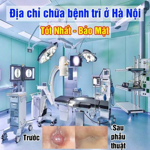 Top 10 địa chỉ chữa bệnh trĩ [Tốt Nhất] ở Hà Nội 2026 [Bảo Mật]