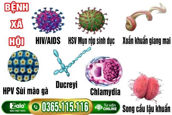 7 bệnh xã hội nguy hiểm thường gặp và dấu hiệu nhận biết