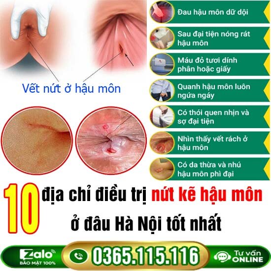 10 địa chỉ điều trị nứt kẽ hậu môn ở đâu Hà Nội tốt nhất 10 địa chỉ điều trị nứt kẽ hậu môn ở đâu Hà Nội tốt nhất