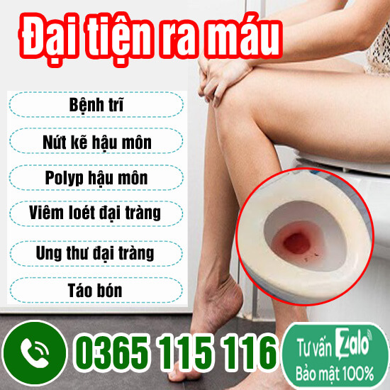 10 địa chỉ khám chữa đại tiện đi ngoài ra máu ở đâu Hà Nội tốt nhất 10 địa chỉ khám chữa đại tiện đi ngoài ra máu ở đâu Hà Nội tốt nhất