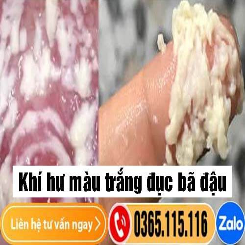 Khí hư màu trắng đục bã đậu không mùi, ngứa