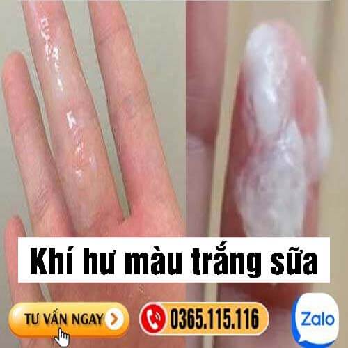 Khí hư màu trắng sữa loãng không mùi không ngứa