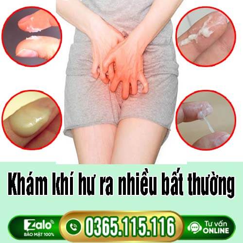 Khí hư ra nhiều khám ở đâu Hà Nội? Top 9 địa chỉ uy tín Khí hư ra nhiều khám ở đâu Hà Nội? Top 9 địa chỉ uy tín