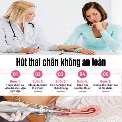 Hút thai chân không: Quy trình 5 bước hút thai an toàn Hút thai chân không: Quy trình 5 bước hút thai an toàn
