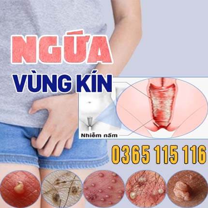 Ngứa vùng kín nữ: Nguyên nhân và cách điều trị giảm ngứa an toàn