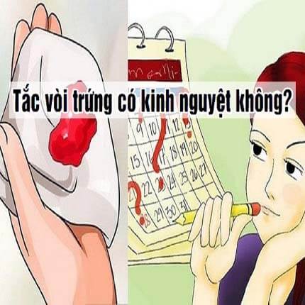 Tắc vòi trứng có kinh nguyệt không? Bác sĩ trả lời