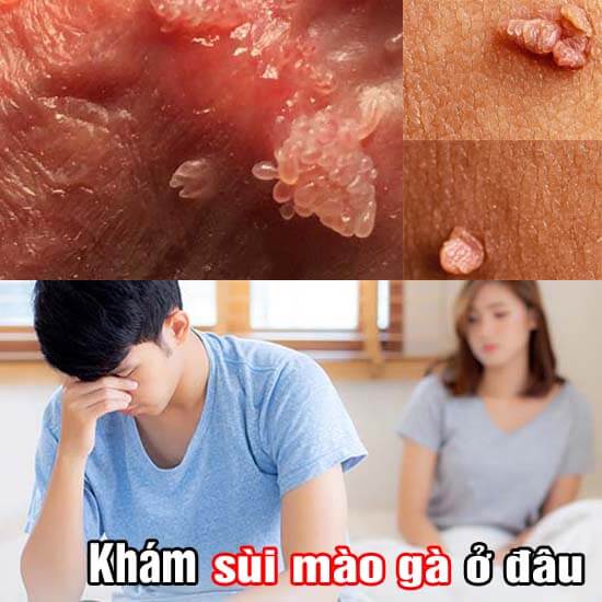 10 địa chỉ phòng khám sùi mào gà tại Hà Nội [Chữa ở đâu tốt] Bảo Mật 2026