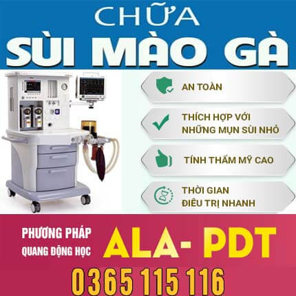 Phương pháp ALA-PDT là gì, có tốt không, bao nhiêu tiền Phương pháp ALA-PDT là gì, có tốt không, bao nhiêu tiền