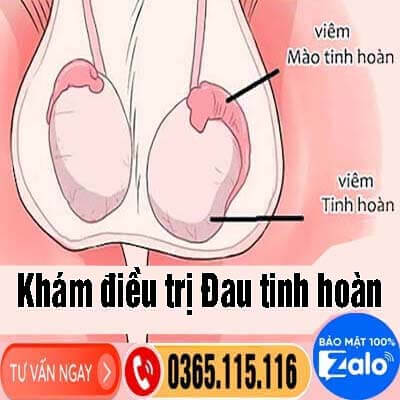 Bị đau tinh hoàn khám ở đâu tốt tại Hà Nội [8 địa chỉ uy tín] 2026